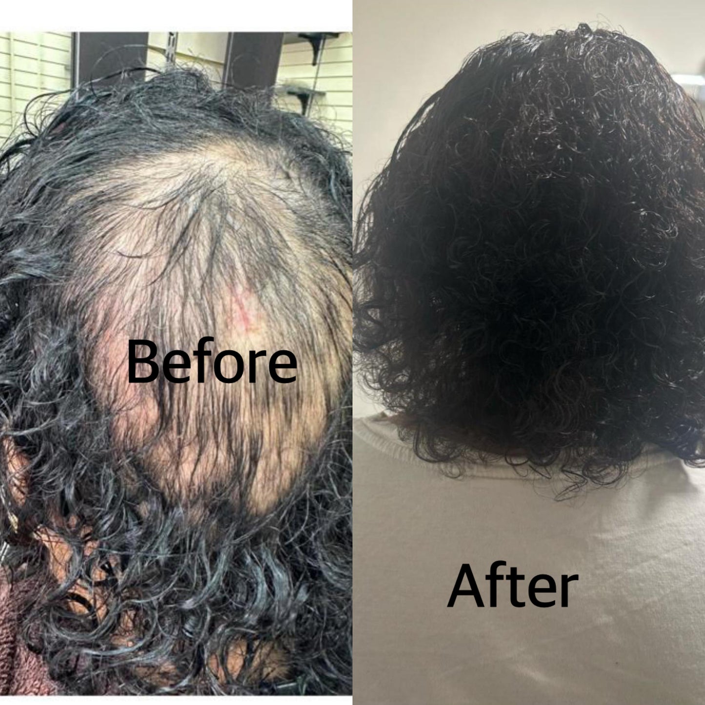 100ml Ayurvedic Hair Growth Oil For Hair Loss